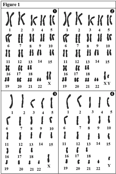 Transfert de l’information génétique au cours de la reproduction sexuée